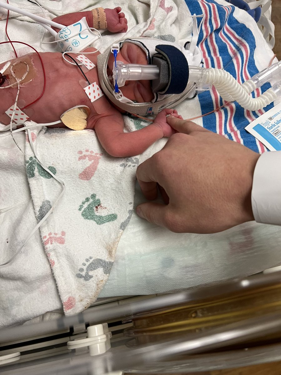 Scottmayfield03's tweet photo. Happy birthday to our beautiful Zinnley belle mayfield 2lb 14oz wanted to come out early to celebrate Christmas https://t.co/8F961ykklh