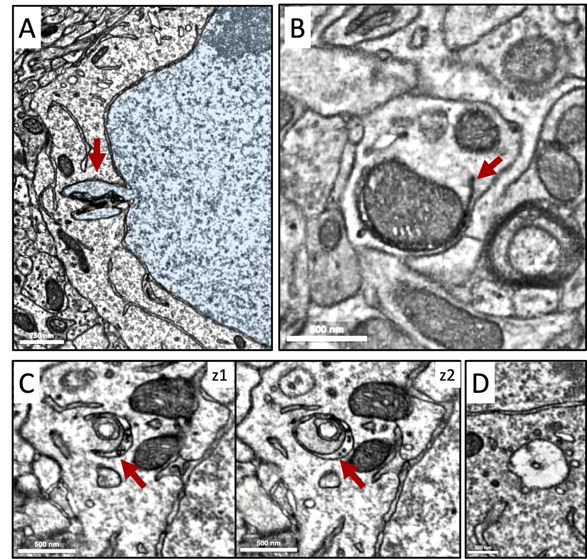 Hanieh Falahati هانيه فلاحتى (@haniehfalahati) on Twitter photo This #EM_Monday is about eating: Nucleophagy (A), mitophagy (B), MVB engulfing something else (C), and a MVB surrounded by vesicles (D). All in neurons, from microns-explorer.org. <a href="/YaleCellBio/">Yale Cell Biology</a> This #EM_Monday is about eating: Nucleophagy (A), mitophagy (B), MVB engulfing something else (C), and a MVB surrounded by vesicles (D). All in neurons, from microns-explorer.org. <a href="/YaleCellBio/">Yale Cell Biology</a>