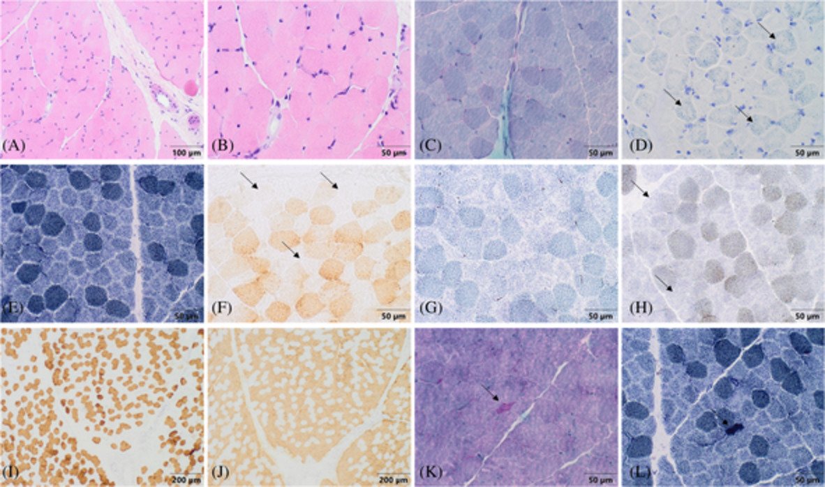 Brain Pathology tweet media