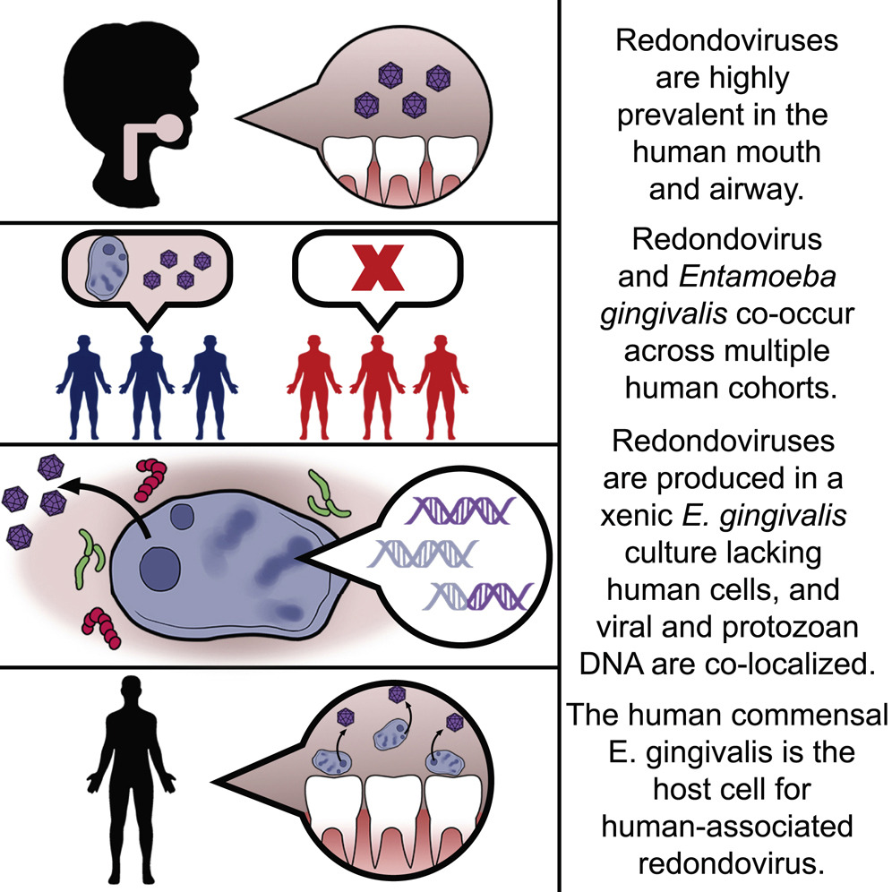 cellhostmicrobe's tweet photo. Redondoviruses call E. gingivalis home: @emviricota @bushmanlab report redondoviruses are associated w/ #Entamoeba gingivalis & appear to replicate in this commensal #amoeba, indicating commensal eukaryotes can host members of human-associated #virome https://t.co/mKxozmrNJq https://t.co/xT16pUTNnw