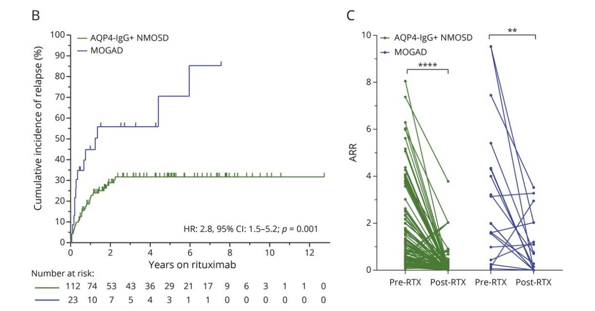Long-term Effectiveness and Safety of Rituximab in Neuromyelitis Optica Spectrum Disorder and MOG Antibody Disease: bit.ly/3UmLuRZ

#NeuroTwitter #NMOSD #MOGAD