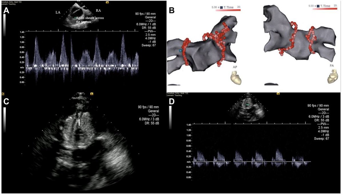 Heart Rhythm Case Reports tweet media