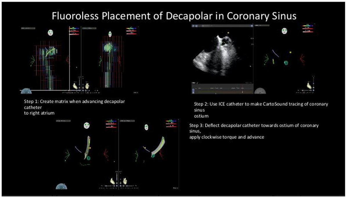 Heart Rhythm Case Reports tweet media