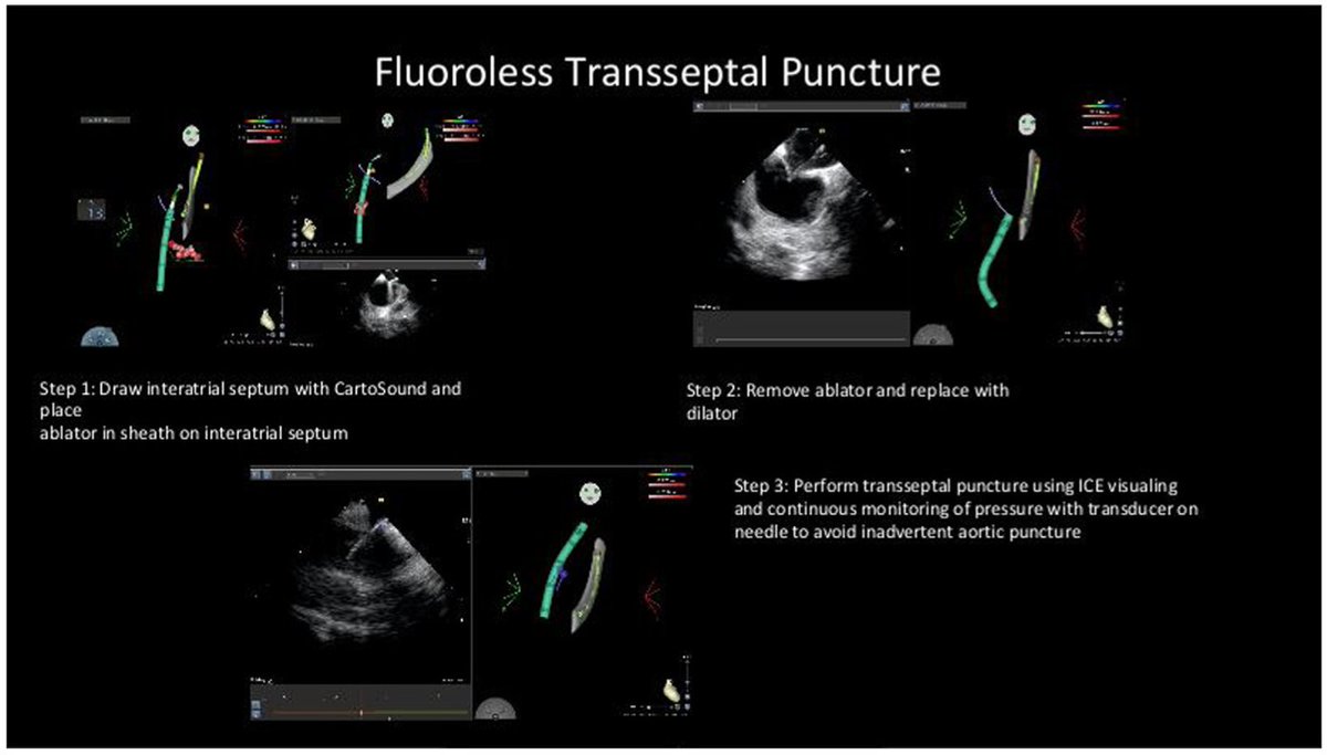 Heart Rhythm Case Reports tweet media