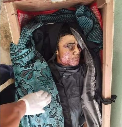 Nandar85526889's tweet photo. Tw // death

According to the list of civilian casualties in #November compiled by Karenni's Voice team, between #November 1 and 30, 3 civilians including Children were killed and at least 29 injured due to #WarCrimesOfJunta in Karenni State.
#StopExecutingOurStudents https://t.co/jEqE0YyAiA