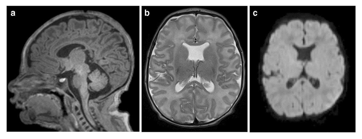 Camilo Jaimes (@camilojaimesc) on Twitter photo Part 2 of 3 - Our take on how to image our youngest patients: NEWBORNS. Practical tips and tricks from best rads <a href="/bedoya3aleja/">Alejandra Bedoya, MD</a> <a href="/Mike_Gee8/">Mike G</a> Ed_Yang, Atsy, @lmXuMD - and bright researchers <a href="/fmachadorivas/">Fedel Machado Rivas</a> <a href="/CortesAlbornoz_/">María Camila Cortés Albornoz</a> — <a href="/MGHImaging/">Mass General Imaging</a> <a href="/boschildrensrad/">Boston Children's Radiology</a> Part 2 of 3 - Our take on how to image our youngest patients: NEWBORNS. Practical tips and tricks from best rads <a href="/bedoya3aleja/">Alejandra Bedoya, MD</a> <a href="/Mike_Gee8/">Mike G</a> Ed_Yang, Atsy, @lmXuMD - and bright researchers <a href="/fmachadorivas/">Fedel Machado Rivas</a> <a href="/CortesAlbornoz_/">María Camila Cortés Albornoz</a> — <a href="/MGHImaging/">Mass General Imaging</a> <a href="/boschildrensrad/">Boston Children's Radiology</a>