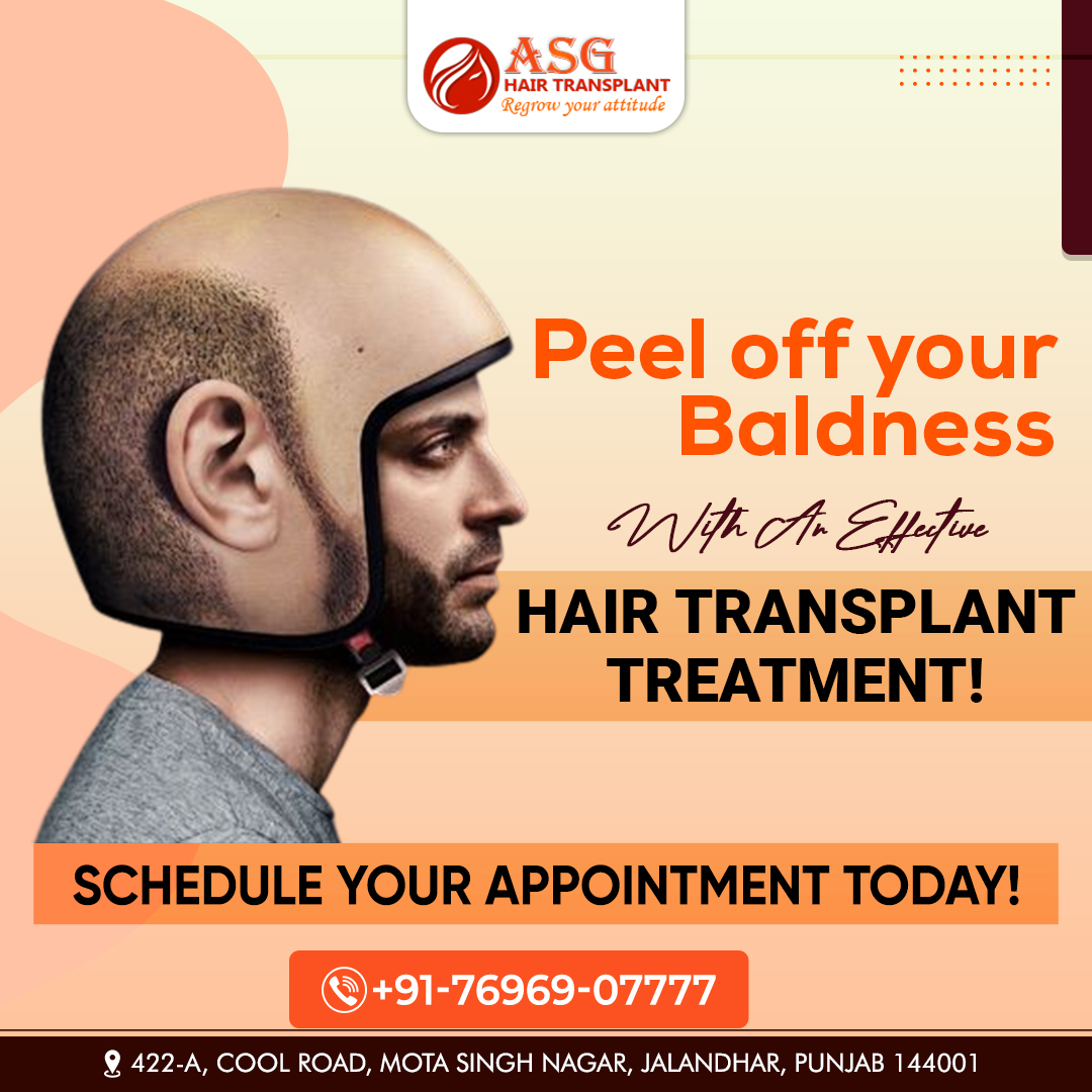 ASG Hair Transplant (@ASGHairCare) / Twitter ASG Hair Transplant (@ASGHairCare) / Twitter