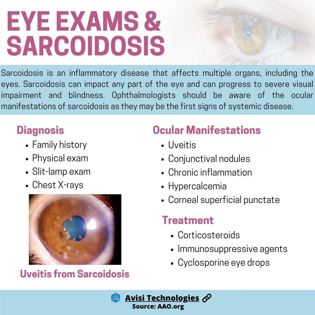 How many of you have sarcoidosis that impacts your eyes?
💜FOLLOW US ON TWITTER!👀
twitter.com/sarcoidfilm
 
#chronicillness #sarcoidosis #invisibleillness #SickNotWeak #Awareness #advocacy #raredisease #documentary