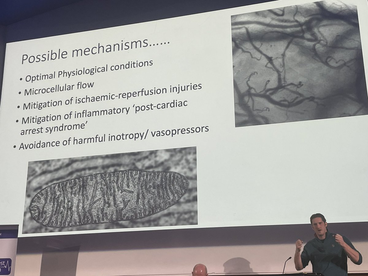 Chris Bishop (@pipes_n_pumps) on Twitter photo Despite very long low-flow times, survival with excellent neurological and functional outcomes is possible with ECPR - this conflicts with our centrally held paradigm of understanding hypoxic-ischaemic injury post-arrest. We’ve more time than we thought! #LCAS2022 <a href="/LDN_TC/">London Trauma Conference</a> Despite very long low-flow times, survival with excellent neurological and functional outcomes is possible with ECPR - this conflicts with our centrally held paradigm of understanding hypoxic-ischaemic injury post-arrest. We’ve more time than we thought! #LCAS2022 <a href="/LDN_TC/">London Trauma Conference</a>