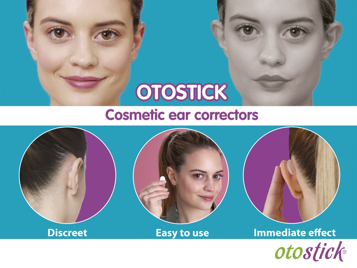 Reduce the appearance of prominent ears with Otostick ear correctors. Discreet, easy to apply, and you'll see immediate results. 

Buy direct from the UK: uk.otostick.com