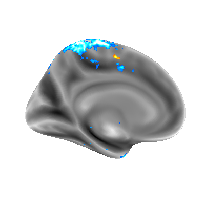 Parietal, INRIA tweet media