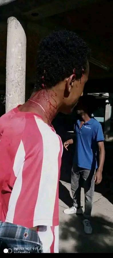 ollaaOromo's tweet photo. Sources confirmed that Adama Science and Technology University  students #protested  the atrocities in Oromia today and the security forces  responded brutally. @EthioHRC @hrw https://t.co/BWLiLyegLI