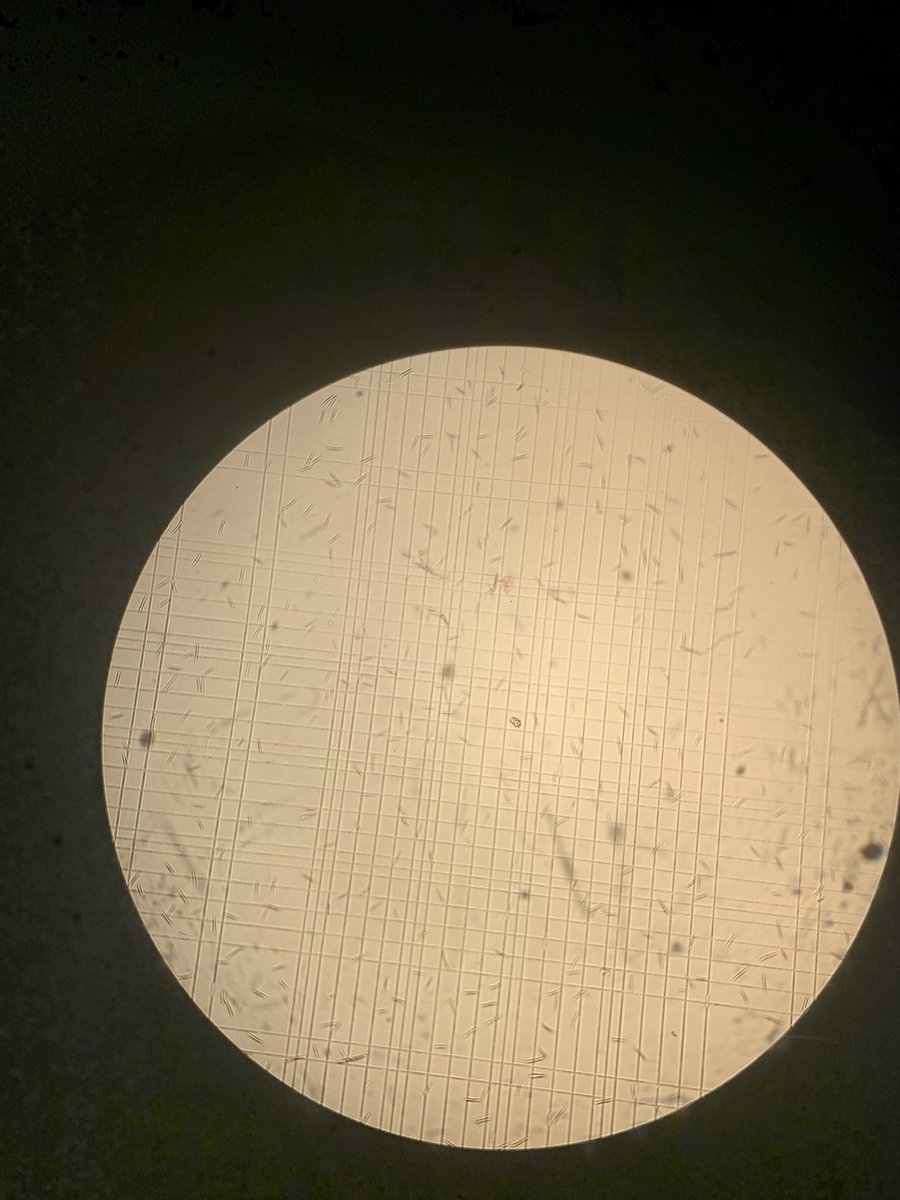 Today, I got to work with Fusarium for the first time! I am trying to infect oat seeds with Fusarium spores. In a few weeks, there will hopefully be some sick plants, which can then be harvested and analyzed further! 🔬🧪🤓