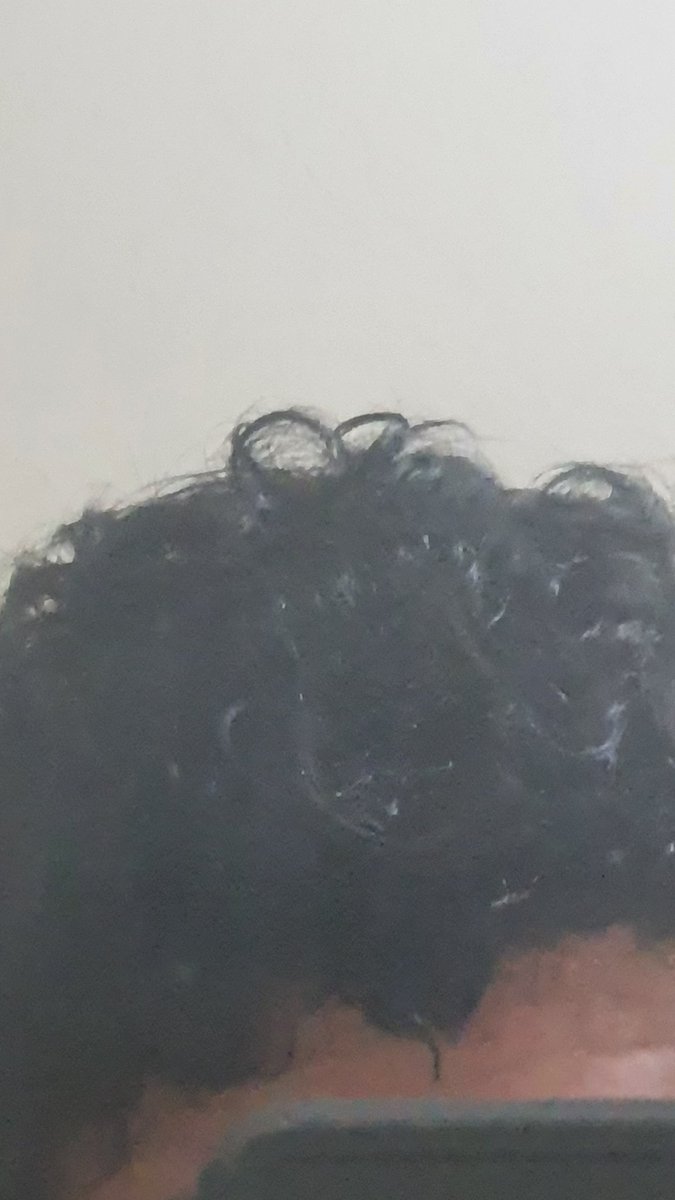 ClownPoke's tweet photo. Un corazoncito en mi desastre de cabello

Espero que tengan bonito dia😊 https://t.co/vGdCbuCDd7