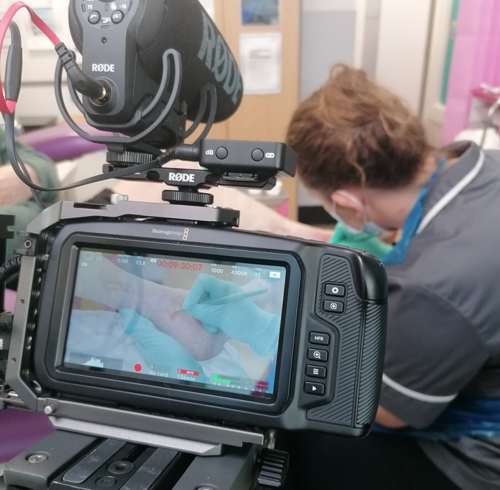 AccelerateCIC's tweet photo. Day 2 of filming, we're filming using a curette for our @leedsbeckett master's module "Advanced wound management and sharp debridement" Follow the link to sign up, closing date for applications is 15th DEC!! 
https://t.co/kuWyi3Tjw4 #sharpdebridement #Woundhealing https://t.co/cc8QDfJsVC