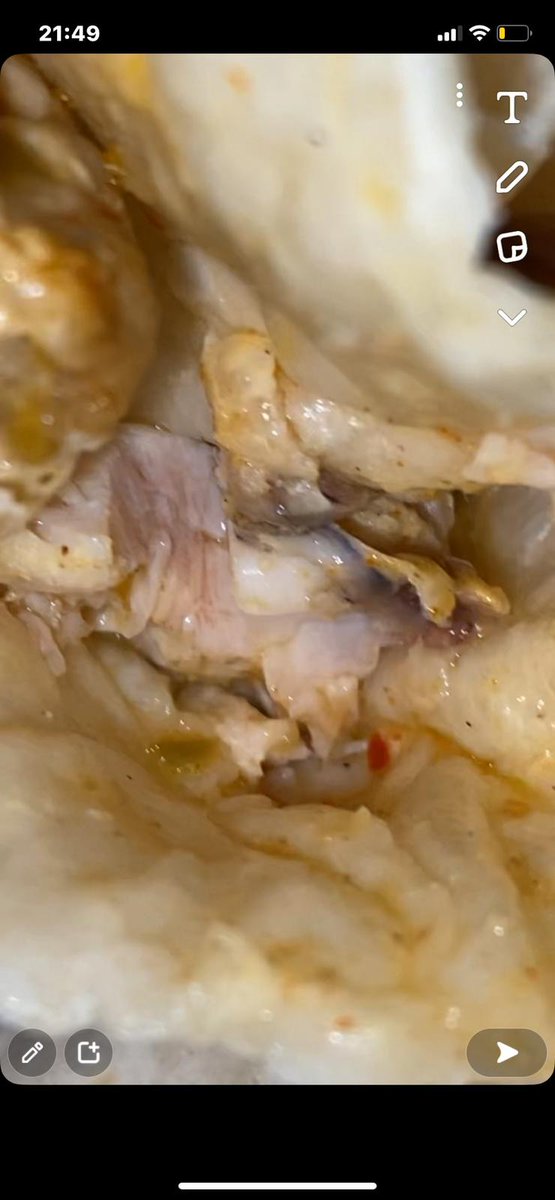 IanKearn's tweet photo. @NandosUK 1/2 my son &amp; pregnant GF were served raw chk spinningfield order15 21.33 021222, manager did partial refund &amp; stated cant get F/poisoning from ur chk!! https://t.co/Cpi3TbvsUg