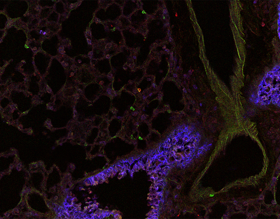 A mRNA #influenza vaccine strategy promoted memory CD4 and CD8 #Tcells in lung tissues of mice, spotlighting how mRNA vaccines could one day protect against more respiratory illnesses. <a href="/KuenzliMarco/">Marco Kuenzli</a> <a href="/Masopust_Vezys/">Masopust Vezys Lab</a> <a href="/CFI_UMN/">CFI-UMN</a>

📄: scim.ag/Lo