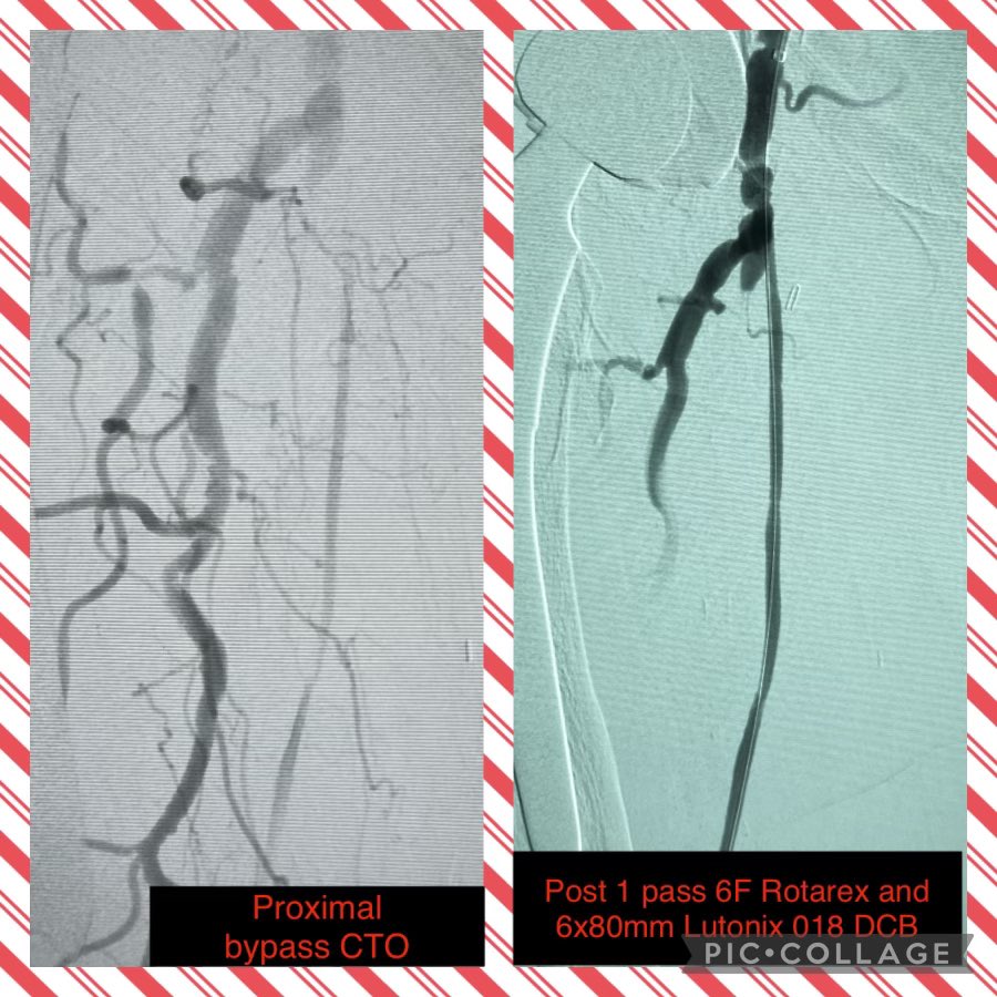 jsilpemd tweet media