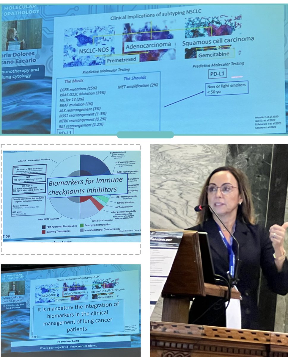 Ritu Nayar, MD (@nayarritu) on Twitter photo <a href="/mdlozanoe/">Lola Lozano</a> ⭐️molecular cytopathologist #MolCytoPath22 sharing pearls on immunotherapy, PLL-1 in lung cancer. ✅ <a href="/mdlozanoe/">Lola Lozano</a> ⭐️molecular cytopathologist #MolCytoPath22 sharing pearls on immunotherapy, PLL-1 in lung cancer. ✅