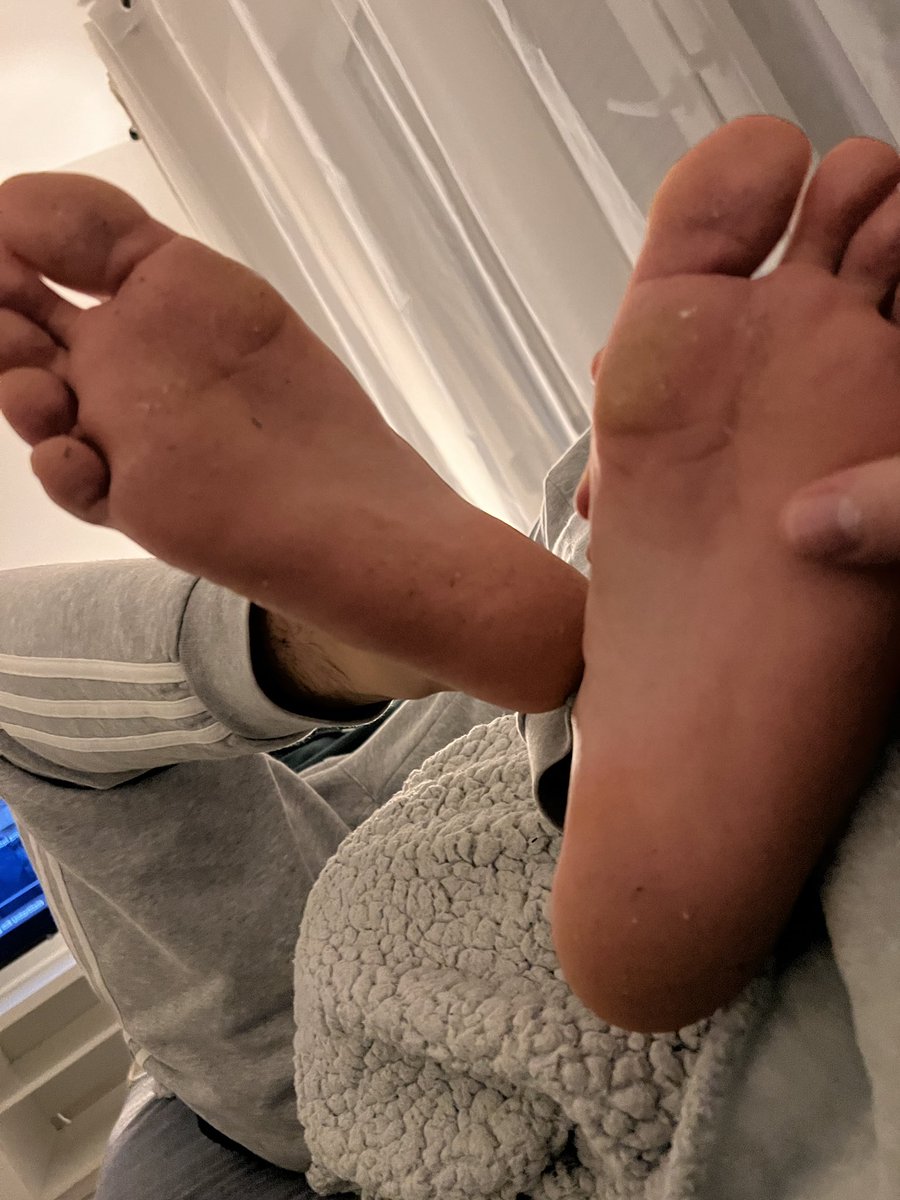 Mastercobra18's tweet photo. Dirty feet for your mouth👄 #feet #cashmaster #cashsub #master #paypig #cashslave #findom #abdrücken @moneyslave333 @tomsoma4 @AlphaMaleRT @alphaxfindomrt @RT4Masters @RtCashmaster @findominfluence https://t.co/FFw9Mn7rku