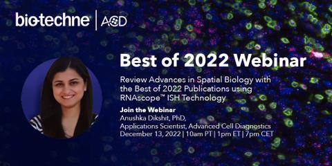 bt_spatial's tweet photo. Join us to review Key 2022 Publications utilizing #RNAscope ISH. Dr Anushka Dikshit will discuss the use of #RNAISH in areas including, neuro, oncology, I-O, cell &amp; gene therapy, scRNAseq validation, and more.
Dec 13, 2022 | 10am PT | 1pm ET 
Register: https://t.co/PjLK9Wa6qt https://t.co/gOTBIR6ovm