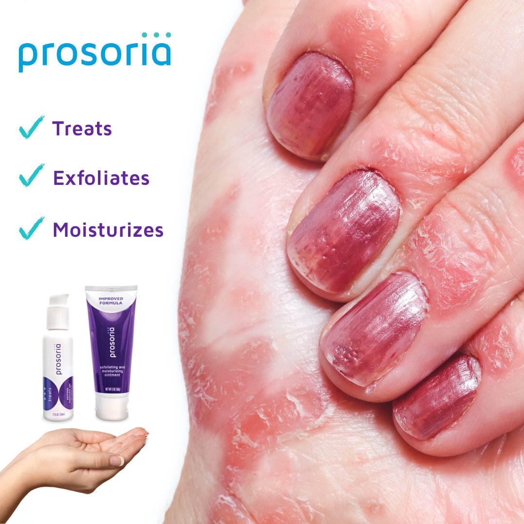 Prosoria tweet media