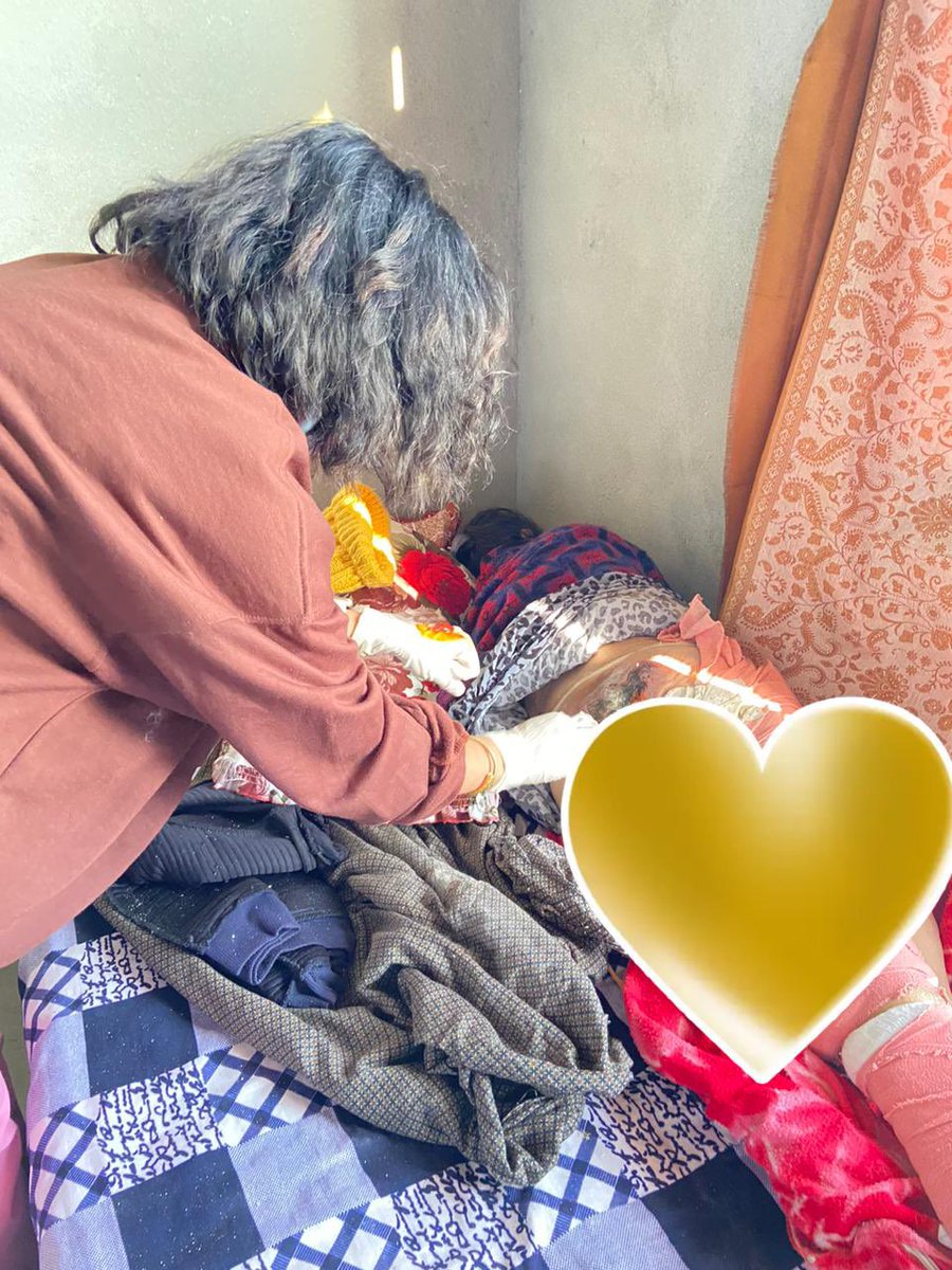 basnet_bhumika's tweet photo. Caring for a bedridden patient
Bed sores can be prevented by moving the patient from one side to another and changing their lying position every 2 hours.
And by giving a good massage as it increases blood circulation.😇#Turuk @USAID_NISHTHA @dm_namchi @AyushmanHWCs https://t.co/HRHVZ72dnH