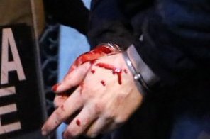 some1fu's tweet photo. Στιγμιότυπο από την προσαγωγή στην Κωλέττη και Μπενάκη(#Exarcheia #εξαρχεια), όπου ο προσαχθέντας φώναζε 

«βλέπεις πόσο αίμα έχω;». 
#μμε #αρδ #NEWS #6december #Γρηγοροπουλος #grigoropoulos 
(info@News247gr) https://t.co/0BoVFZEr94