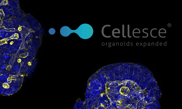 ✨BIG NEWS AHEAD!✨ Today, we acquired <a href="/Cellesce/">Cellesce</a>, specialists in contract development and manufacturing of large scale patient-derived organoids (PDOs) for diverse applications, including drug screening: ow.ly/FIIt50LWBN8. 

#drugdiscovery #organoids #3dbiology