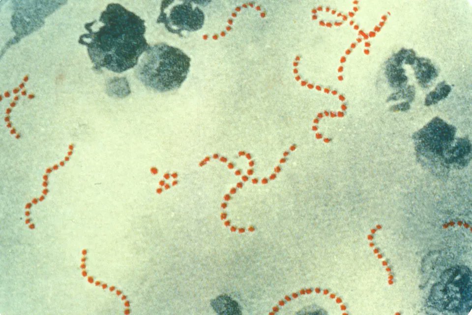 IslingtonLibDem's tweet photo. Latest @UKHSA update on scarlet fever and invasive Group A strep, including symptoms, when to call 111 and when to call 999

#StaySafe 

https://t.co/0Pm2YgwRbc https://t.co/zrKUNONjak