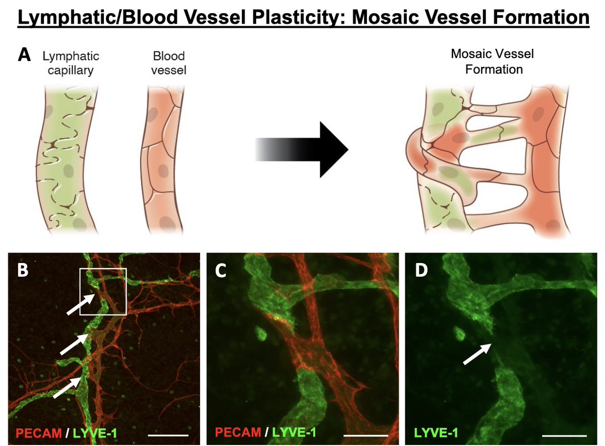 ajpheartcirc's tweet photo. #ArticlesInPress: Lymphatic/Blood Vessel Plasticity: Motivation for a Future Research Area Based on Present and Past Observations
(Lampejo, et al)
https://t.co/FUib5r67vB
@lee_murfee @UFBME 
#Lymphatic  #Microcirculation  #Plasticity  #Angiogenesis https://t.co/7waI4jCzlf