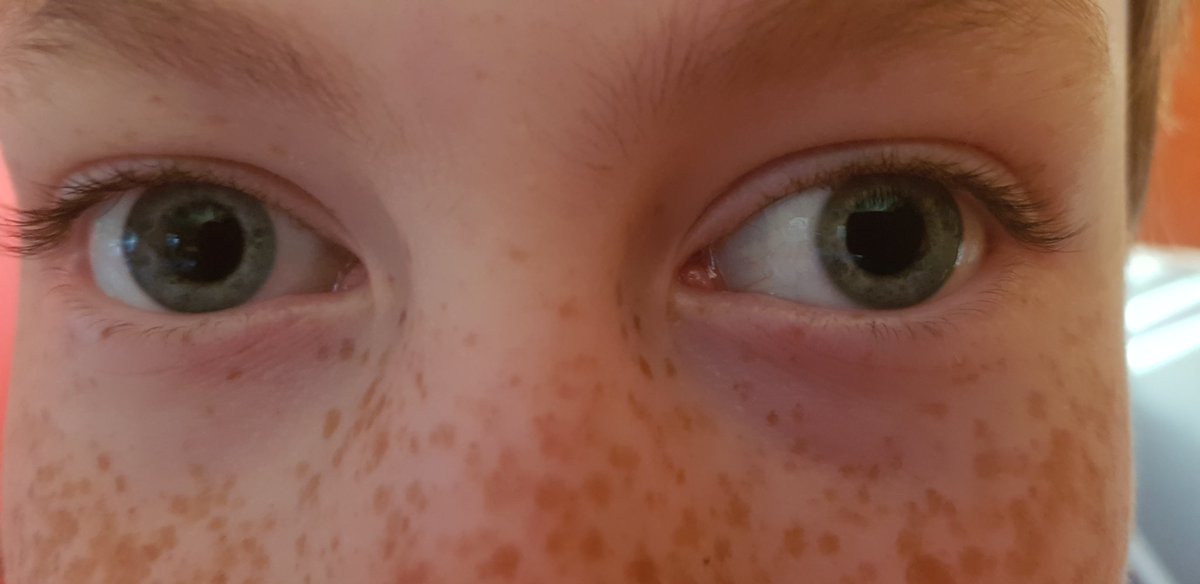Evening all, sorry we are late. Had to take these big beautiful eyes to a specialist. One of these eyes is colour blind, Left or Right, what do you think? Hope your all having a busy night #louthchat #stockwellAfoods