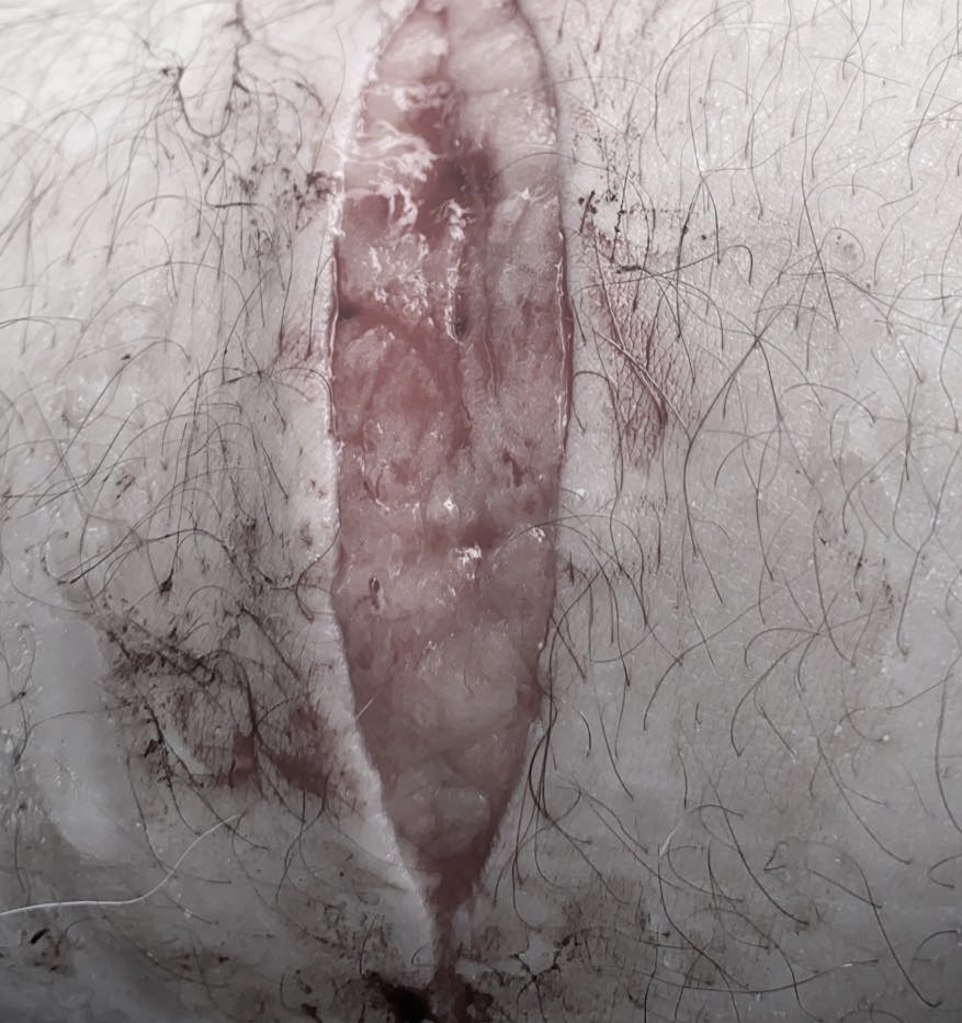 000Wrm's tweet photo. Way wider than I remember 😳#shtwt #beanstwt #fasciatwt #madeofbeans #armgills #sliceytwt https://t.co/YYXuCucW9G