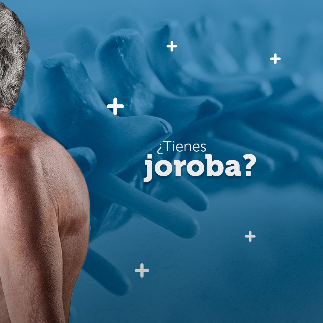 acsocolombia's tweet photo. ¿Dolor de espalda? ​

Consulta con el médico si ves esta señal de alerta. ​La cifosis o joroba suele deberse a la debilidad de los huesos de la columna vertebral, que hace que se fracturen y compriman. 

#ACSO #ACSOCol #Osteoporosis #SaludÓsea #TusHuesosNosImportan https://t.co/eJAjPgAn27