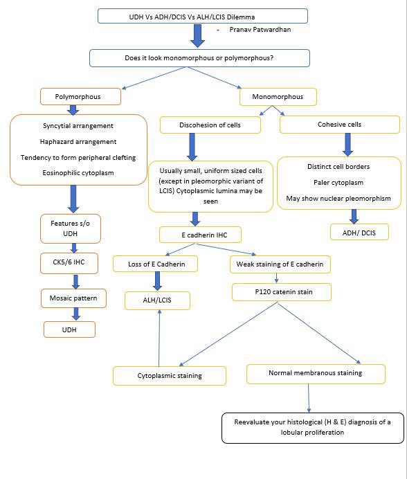 pranavp01's tweet photo. A quick review of UDH Vs ADH/DCIS Vs ALH/LCIS. Monotony, strong ER expression are clues of a neoplastic process rather than UDH. Discohesion, cytoplasmic vacuoles are clues of a lobular process. E-Cadherin/P120 stain is helpful. #PathTwitter https://t.co/ZdZDU9mgtg