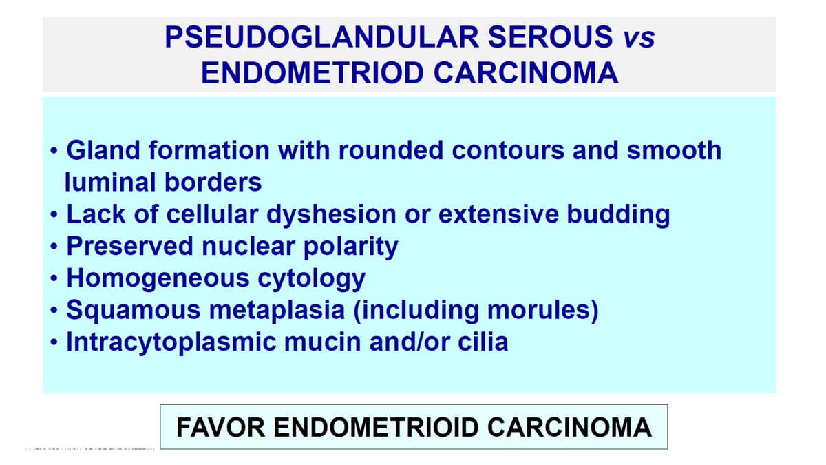 Janiranavarro's tweet photo. Uterus
Endometrioid Carcinoma-Morphologic clues
-Glands with smooth luminal borders
-Lack of cellular dyshesion 
-Nuclear polarity
-Homogenous cytology
-Squamous metaplasia
-Intracytoplasmatic mucin or cilia
Dr.Oliva MGH
#everydayGYN #gynpath #PathTwitter #pathology #pathresident https://t.co/qQwFhtc9ds