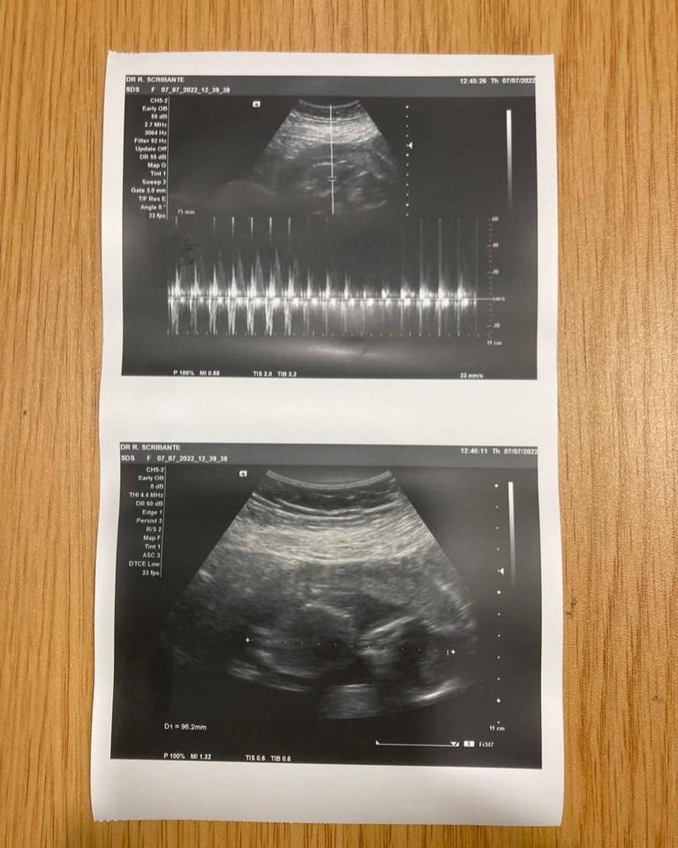 Cruzer244's tweet photo. With our journey with our pregnancy we received 6 visits, 2d scans and emails weekly. To find out more on what @BestmedScheme offers click on the link —> https://t.co/STBiGrzsGB

#58Years #PersonallyYours #MedicalAid #SwitchToBestmed #BestmedRulesApply #JustBeWithBestmed #Ad https://t.co/JTmJpWlYqQ