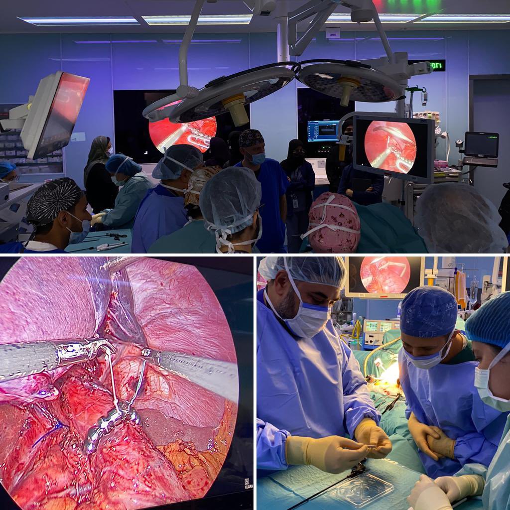 AshrafMaghrabi's tweet photo. Had a wonderful day in our 1st mission of #LINX Proctorship Progam at King Abdullah Medical City, Riyadh, Saudi Arabia.
Spreading new technology of #GERD patients management across the globe.
Thanks to the amazing team.
Johnson & Johnson
@ForegutSociety
@SaudiGTS https://t.co/pDF7Upr9WV