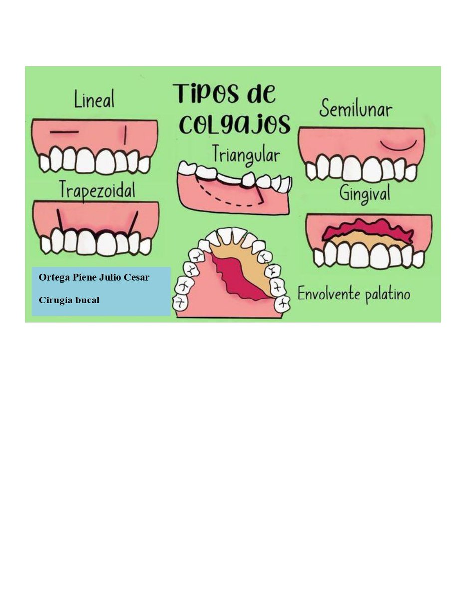 CesarPiene's tweet image. Tipos de colgajo