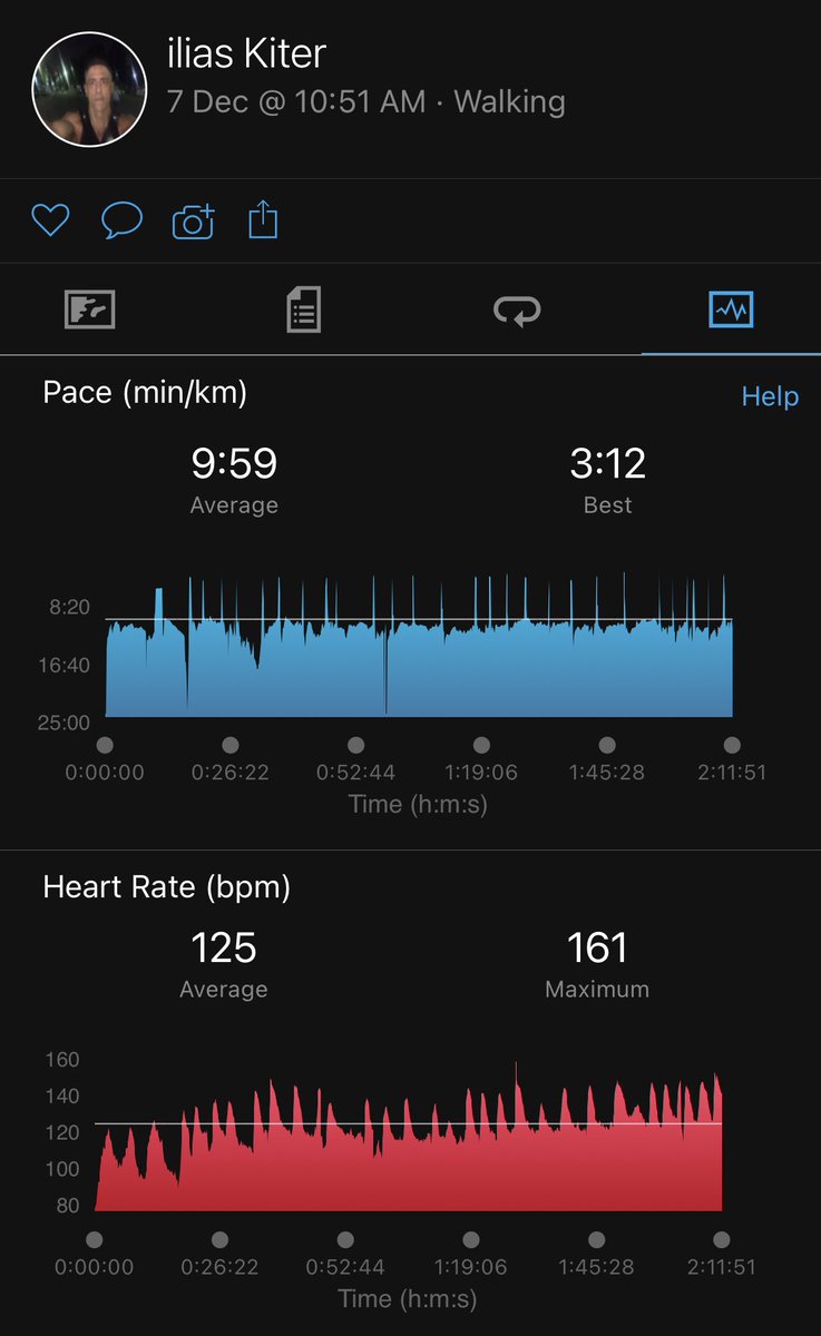 iliasTzanet's tweet photo. #mycancerjourneyilias #chemo7 #hypercvad โ
done! TODAY I started my daily run training with strides DISTANCE 13km @ #racepace & felt great ! One more #chemo8 to go ! #Hdmtx #acutelymphoblasticleykemia #alanwatts #lifeisagame #hereandnow https://t.co/H8bgOTGgXj