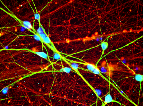 WChristho's tweet photo. ***Ph.D. Student Job Alert***
My lab is looking for a highly motivated student interested in the "Molecular Mechanisms of Major Depression". Please visit my homepage https://t.co/6mWY2vtZCU and https://t.co/ML3aVXVckz for more information https://t.co/BGNXFvEUE4