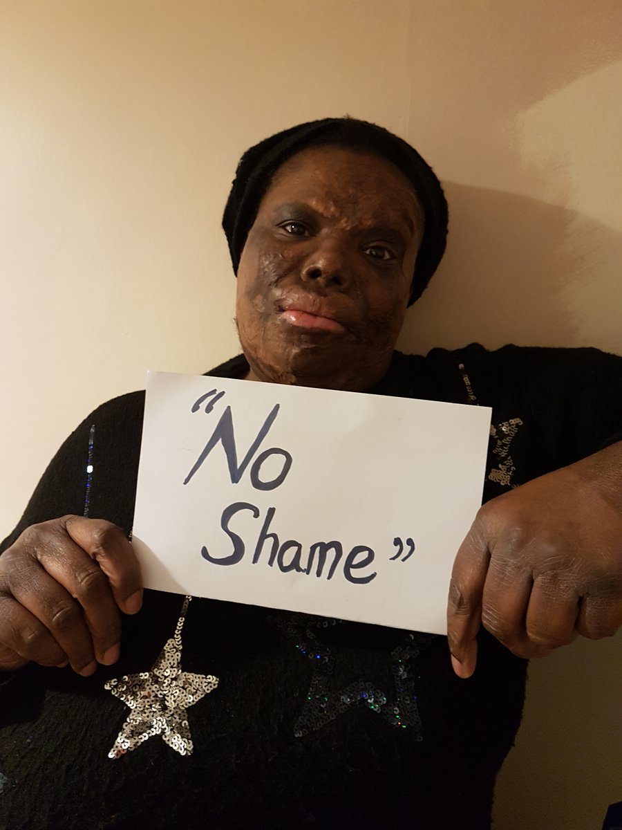 Dear <a href="/BBC/">BBC</a> &amp; <a href="/OnlyConnectQuiz/">OC</a>.

We were disappointed and shocked to see scars described as “marks of shame” on your show recently. 

There is #NoShame in having a scar.

🧵(1/2)