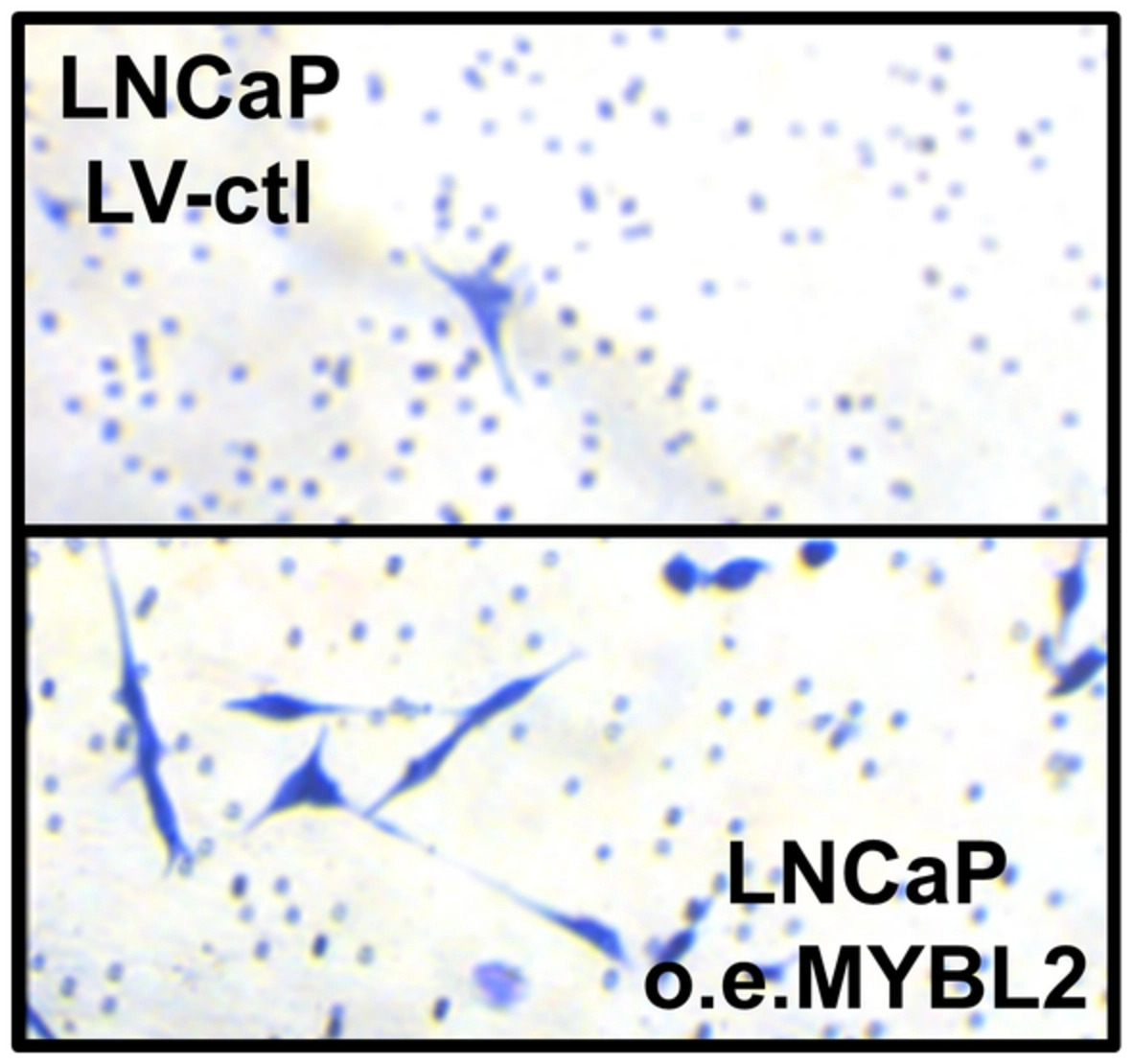 MolOncology's tweet photo. Loss of the histone demethylase KDM5D leads to in vitro resistance of prostate cancer cells to androgen deprivation therapy (ADT) with and without docetaxel
What drives this KDM5D effect?
➡️https://t.co/uJbhDChvhk
#PCSM #HormoneSensitive @ChrisSweens1 https://t.co/wAthBzomKI