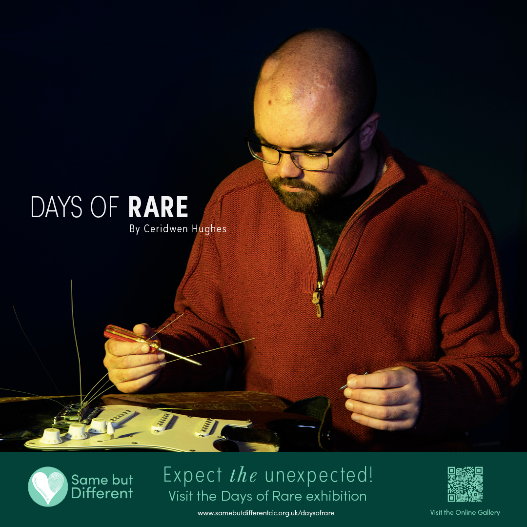 SBDRareProject's tweet photo. We're grateful that we were able to include Rhys in our #DaysofRare project, his story is one of perseverance &amp; hope, despite all odds. He works hard to raise awareness of #SuperficialSiderosis: 

https://t.co/wmnjezf7Rq

@RhysHolmes 
@LivingwithSS
@spinalCSFleak
@csfleakaware https://t.co/1SwyUifbGH