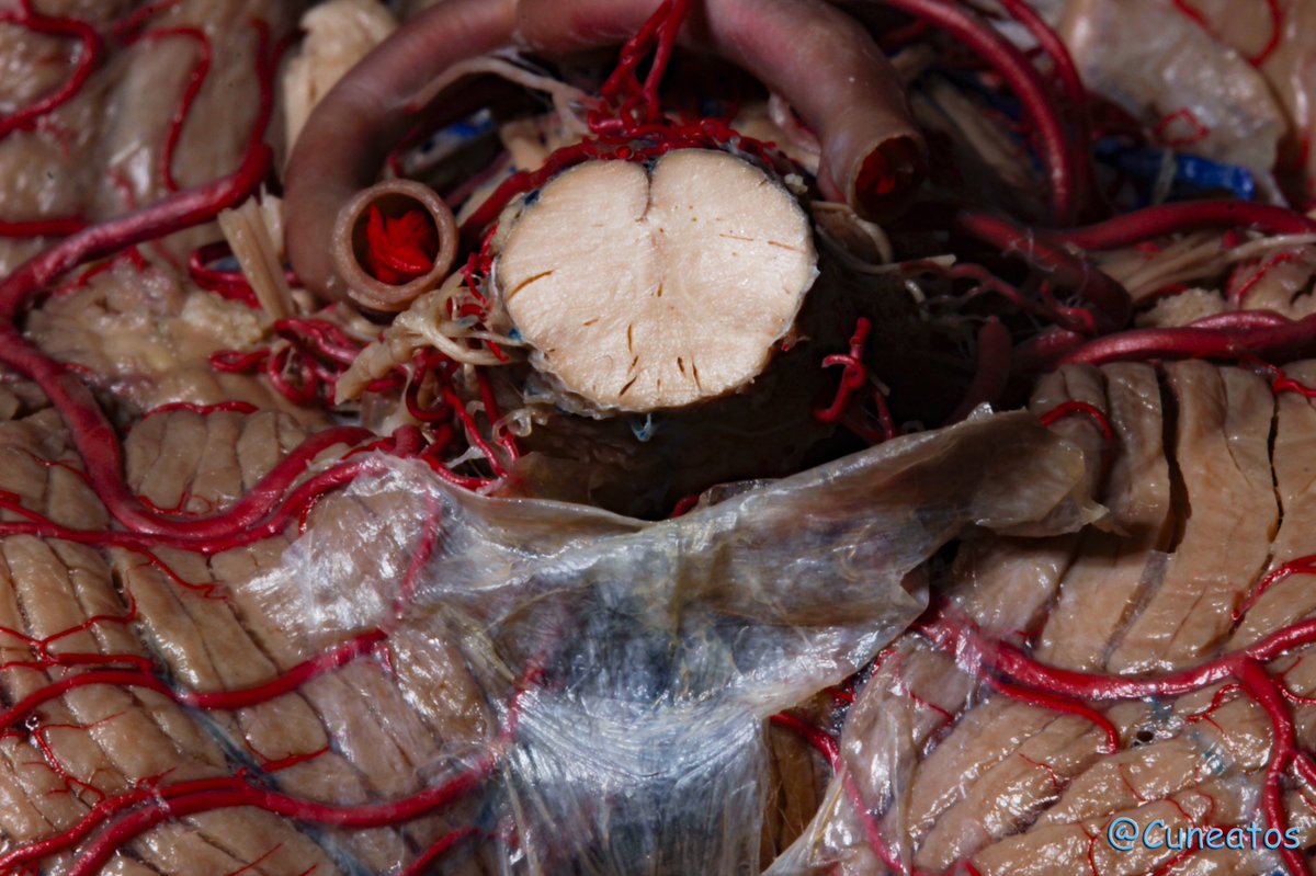 Cisterna magna. <a href="/NeurosurgA/">Neurosurgical Anatomy</a>