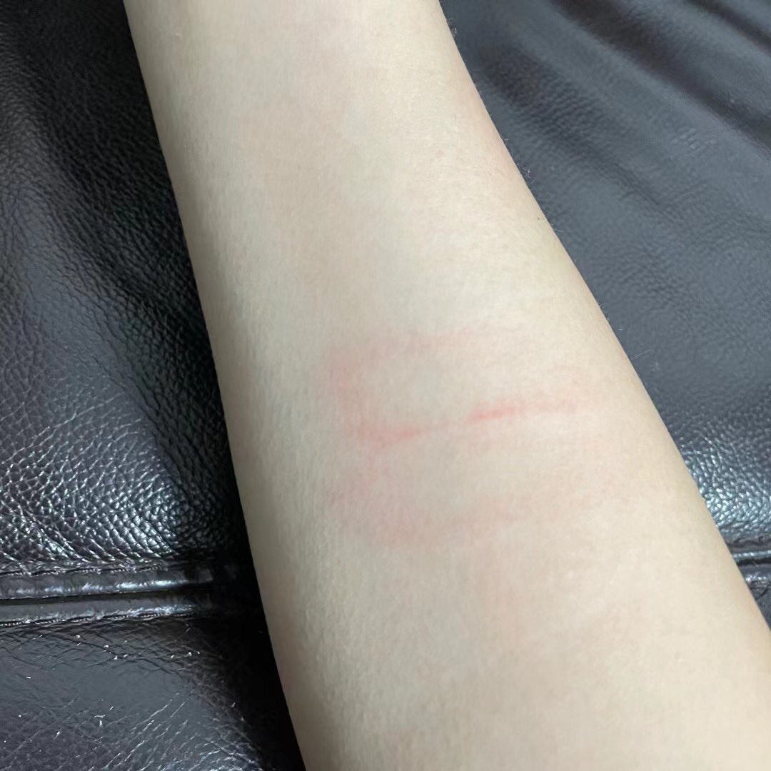 小伤痕（小🐑人版 (@Rui1ove) / Posts / X
