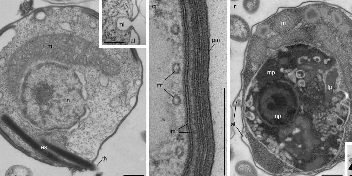 Rare eukaryovorous predators are a new supergroup of eukaryotes! So happy to see this out in @Nature 🥳 Massive congrats to Denis T (the mastermind of hunting incredibly rare protists and culturing them!) and all other co-authors! Check it out ---> rdcu.be/c1b8Z