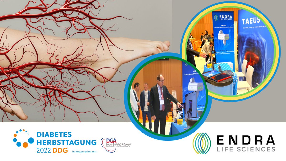 endralifesci's tweet photo. ENDRA's German team enjoyed demonstrating the Thermo Acoustic Enhanced Ultrasound (TAEUS) system for early detection of NAFLD at the German Society for Diabetology 2022. #TAEUS #ENDRA #NAFLD
https://t.co/F22V8vSTnD
$ndra #nasadq #nafld #taeus #diabetology @endralifesci https://t.co/YgqbRugHKl