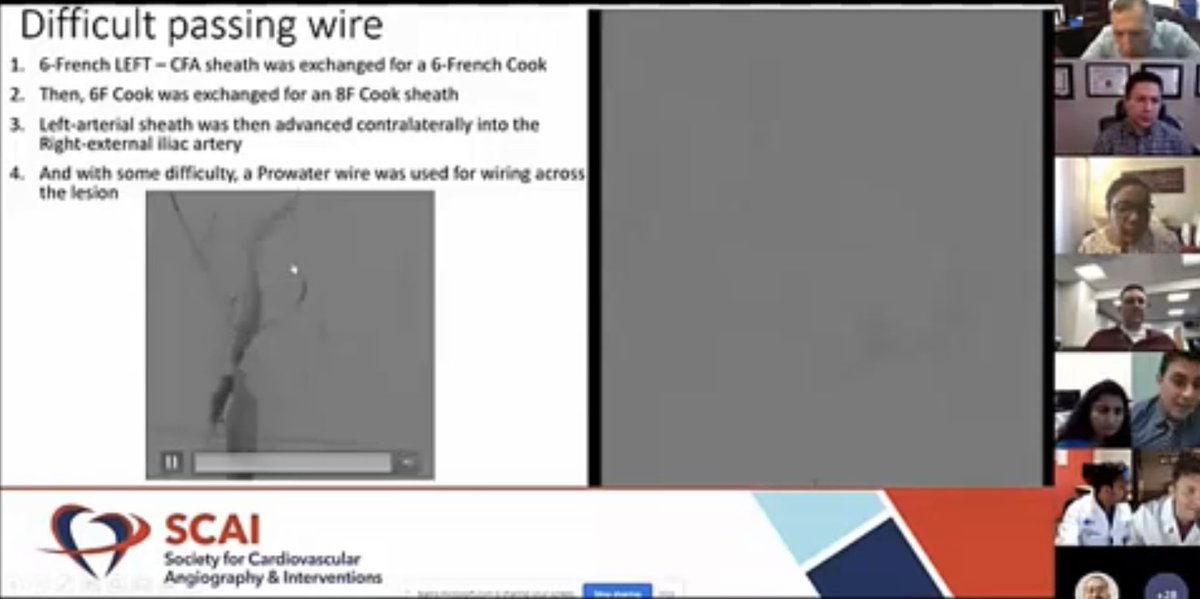 HadyLichaaMD's tweet image. @SCAI @ACCinTouch webinar on the management of #LargeBoreAccess #VascularComplications: #Perforation #Dissection #Bleeding

acc.org/Education-and-…

@DrDamluji @agtruesdell @Babar_Basir @w_jyg @AnkurKalraMD @EricSecemskyMD @DougDrachmanMD @prkothapalli #Cardiotwitter #ACCIC