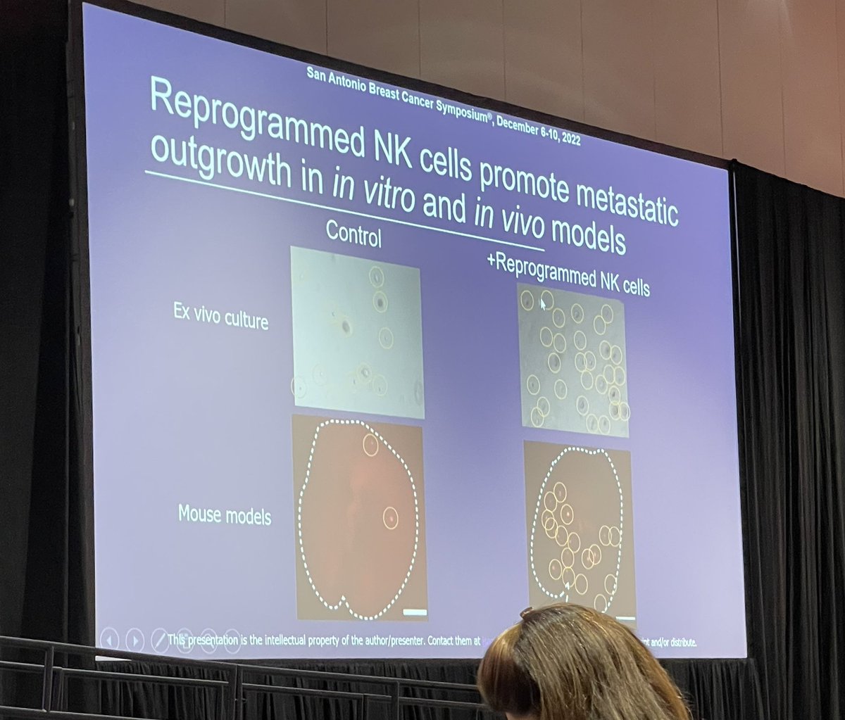 Exciting talk by @ithinkichan from @utswcancer on NK cells and dormancy as well as suppressive role of tumor reprogrammed NK cells at #SABCS22!